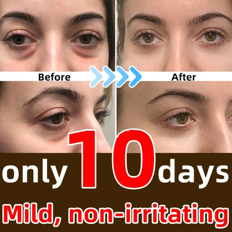 7 Days Anti-Wrinkle Magic Eye Cream Remove Eye Bags Dark Circles Puffiness Lift Firm Smooth Skin Care Moisturizing Massage Serum