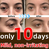 7 Days Anti-Wrinkle Magic Eye Cream Remove Eye Bags Dark Circles Puffiness Lift Firm Smooth Skin Care Moisturizing Massage Serum