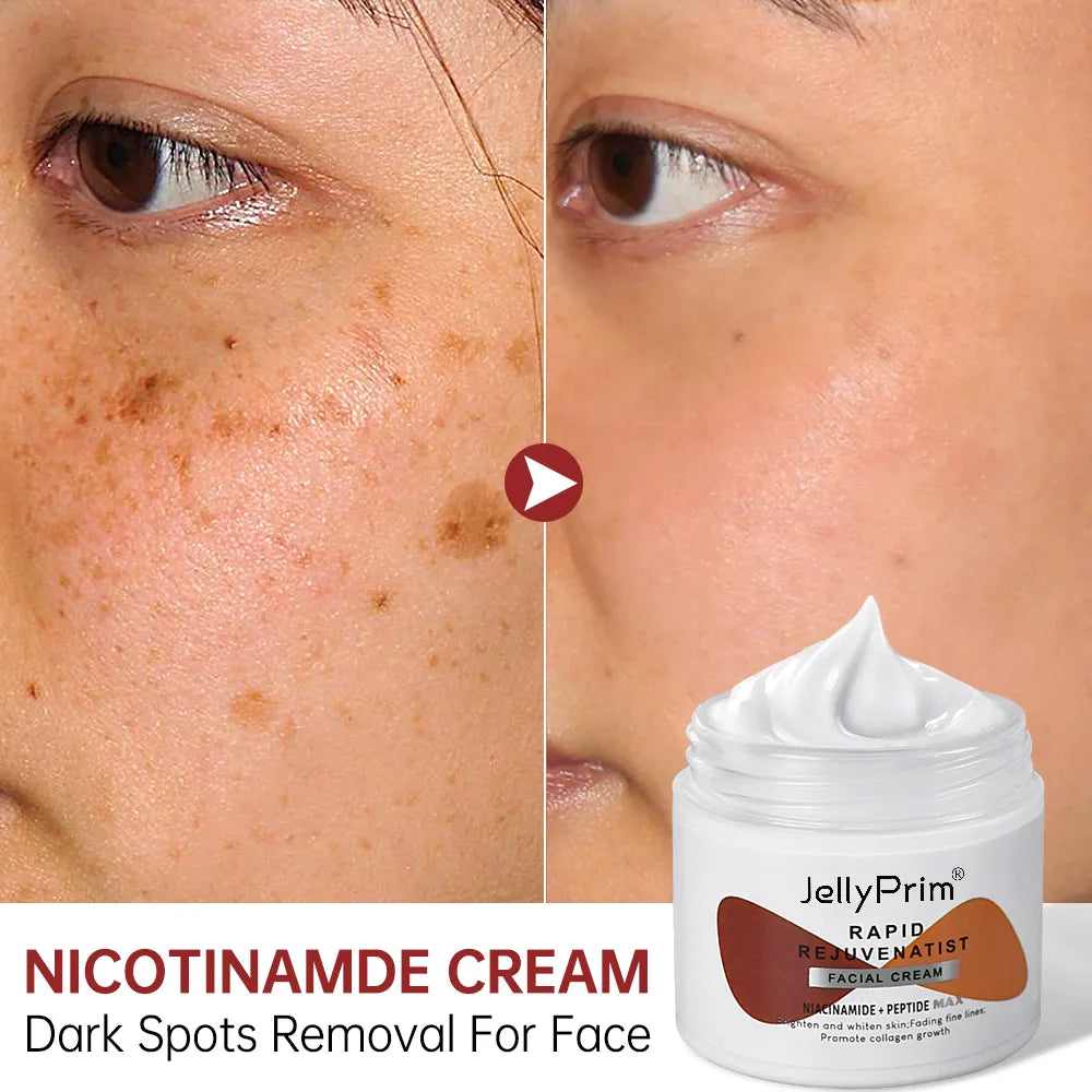 Nicotinamide Whitening Face Cream Dark Spots Pigment Remover Lightening Creams Moisturizing Whitener Skin Care Women Products