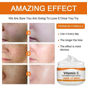 Vitamin C Face Cream Remove Dark Spots Whitening Care Moisturizing Anti-Aging Anti Wrinkle Firming Skin Care Cosmetics