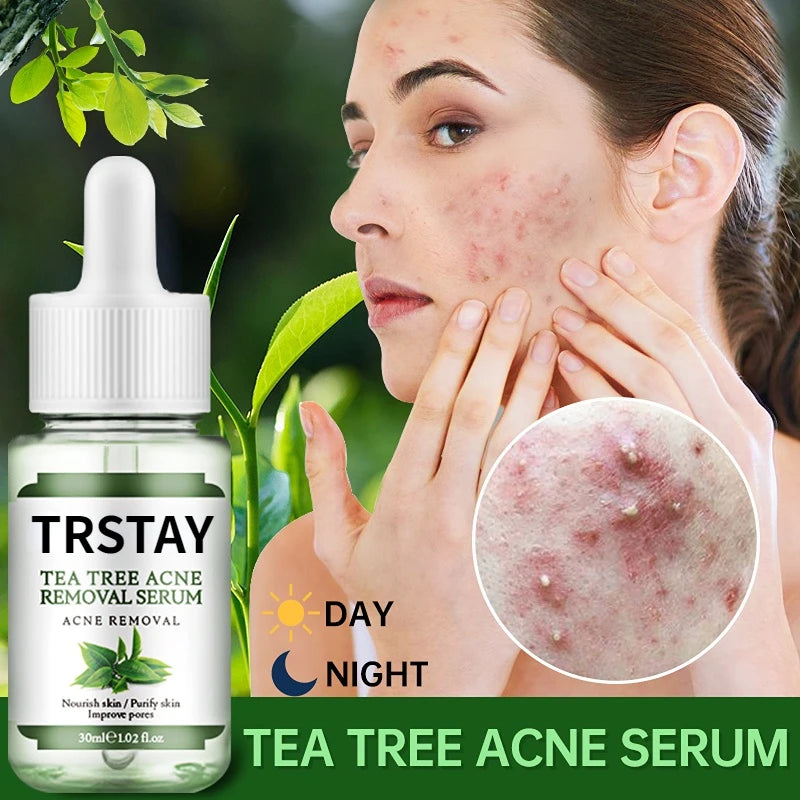 Acne Treatment Face Serum Tea Tree Oil Essence Moisturizing Shrink Pores Acne Facial Serum Korean Skin Care Products