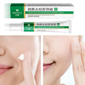 1pcs Herbal Acne Removal Cream Whitening Moisturizing Shrink Pores Oil Control Pimples Acne Treatment Gel Skin Care Face Cream