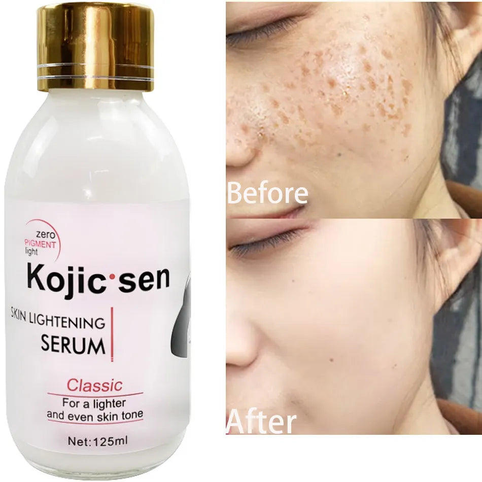 125ml Kojic Sen Whitening Serum Strong Brightening Fade Stubborn Dark Spots and 50g Lightening Face Cream Set For Black Skin