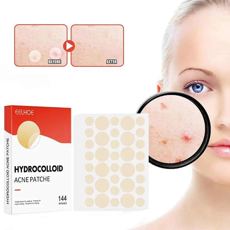 144pcs/set Face Skin Care Acne Pimple Patch 2 Sizes Invisible Professional Healing Absorbing Spot Sticker Covering for Men Women