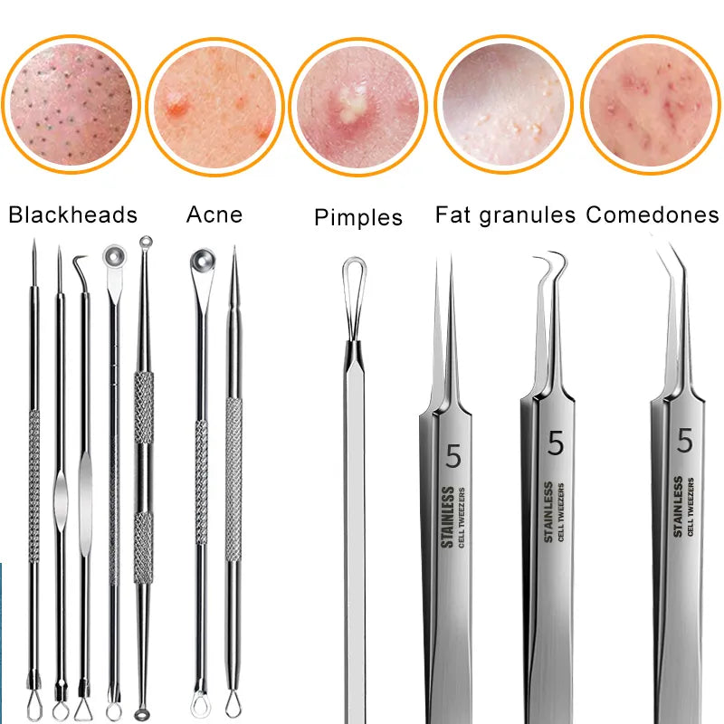 11PCS Ingrown Hair Tweezers Acne Blackhead Removal Needles Black Dots Cleaner Pore Cleaner Deep Cleansing Face Skin Care Tools